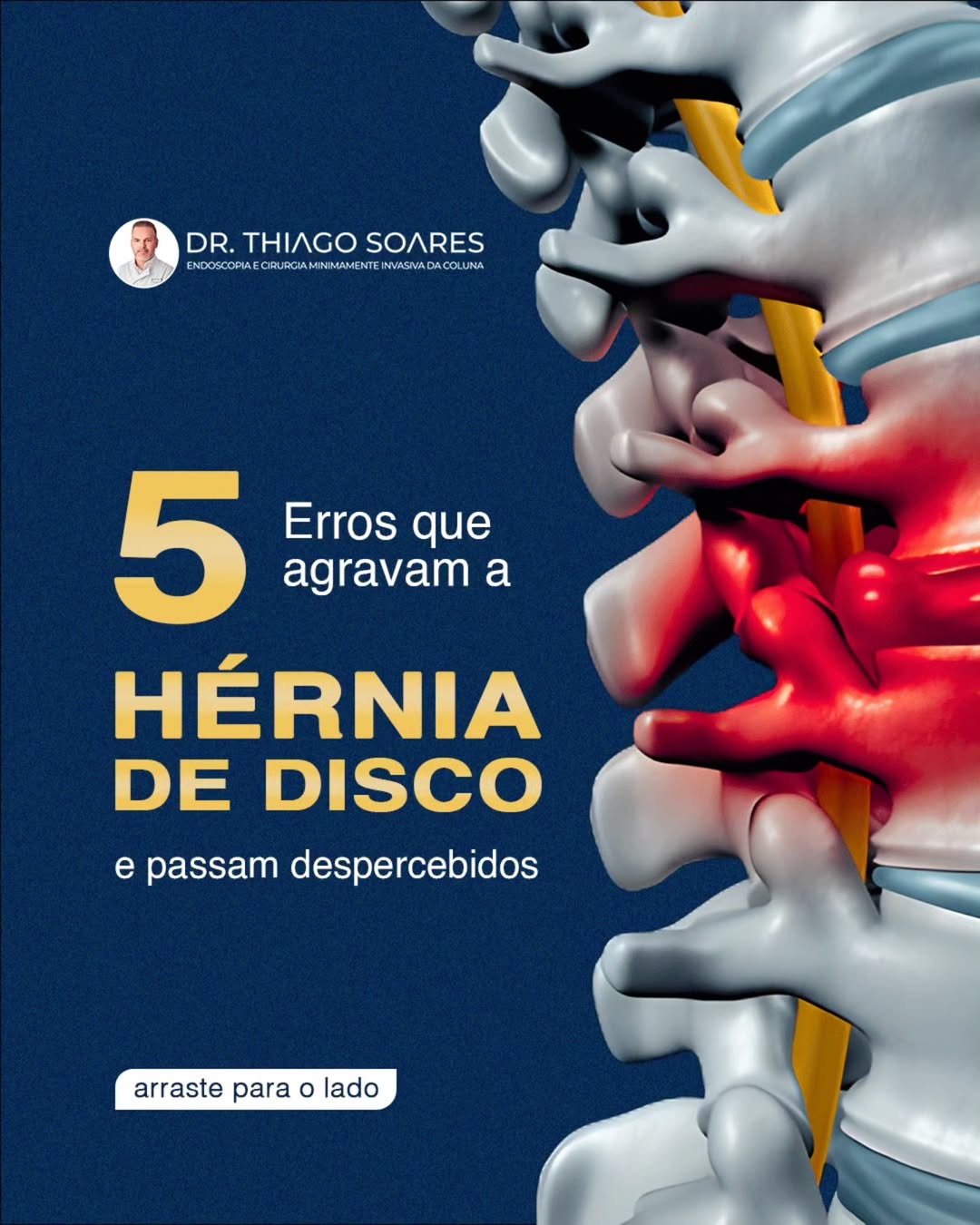 5 erros que podem estar agravando a sua hérnia de disco e você pode nem perceber. ⚠️No dia a di
