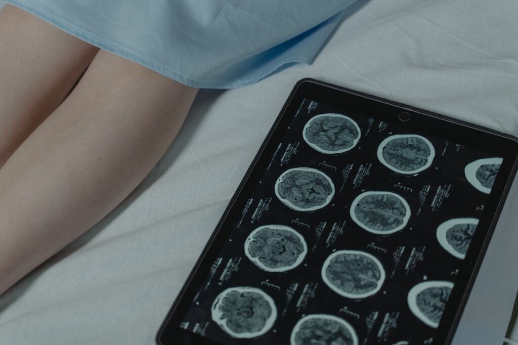 marketing neurologistas tecnologia