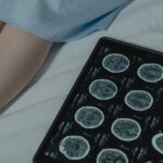 marketing neurologistas tecnologia