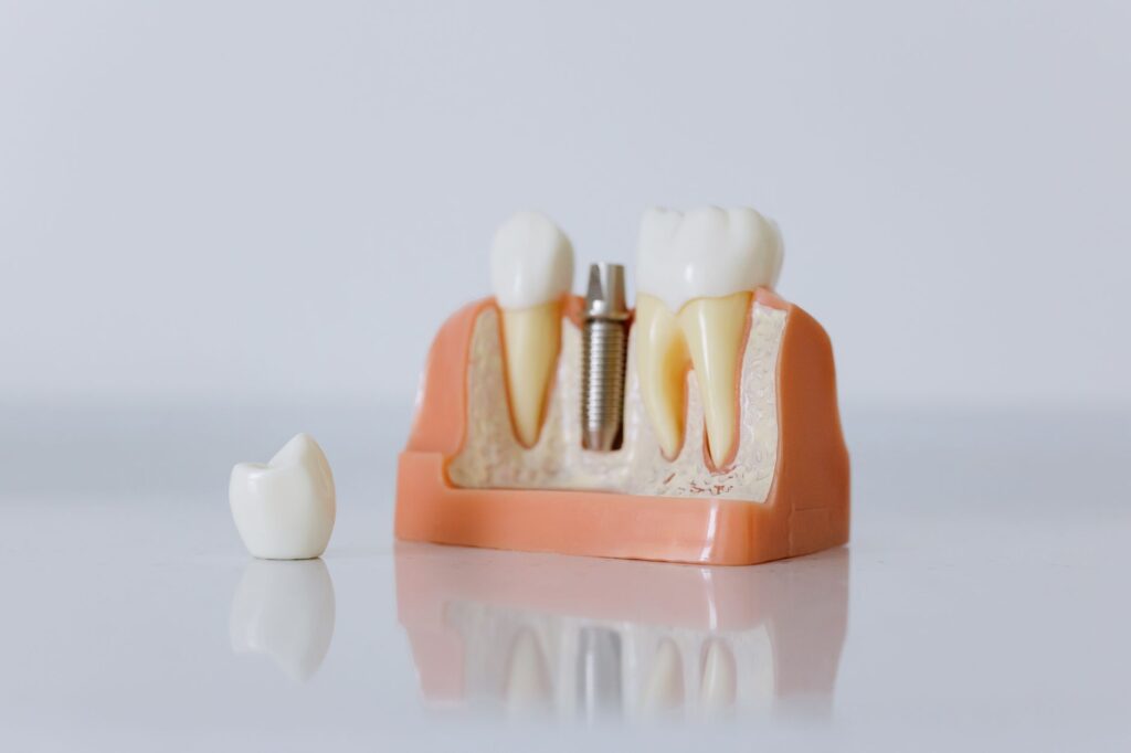 posicionar especialista implantes cidade