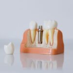 posicionar especialista implantes cidade