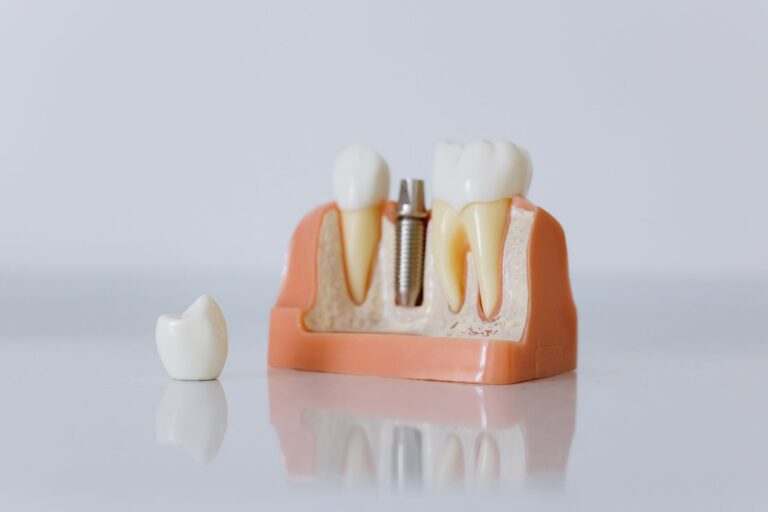 posicionar especialista implantes cidade